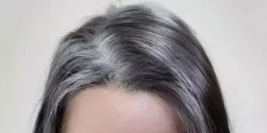 How to Turn Your White Hair Black Naturally